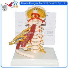 ISO Advanced Cervical Spine Model con Nervios y Músculos